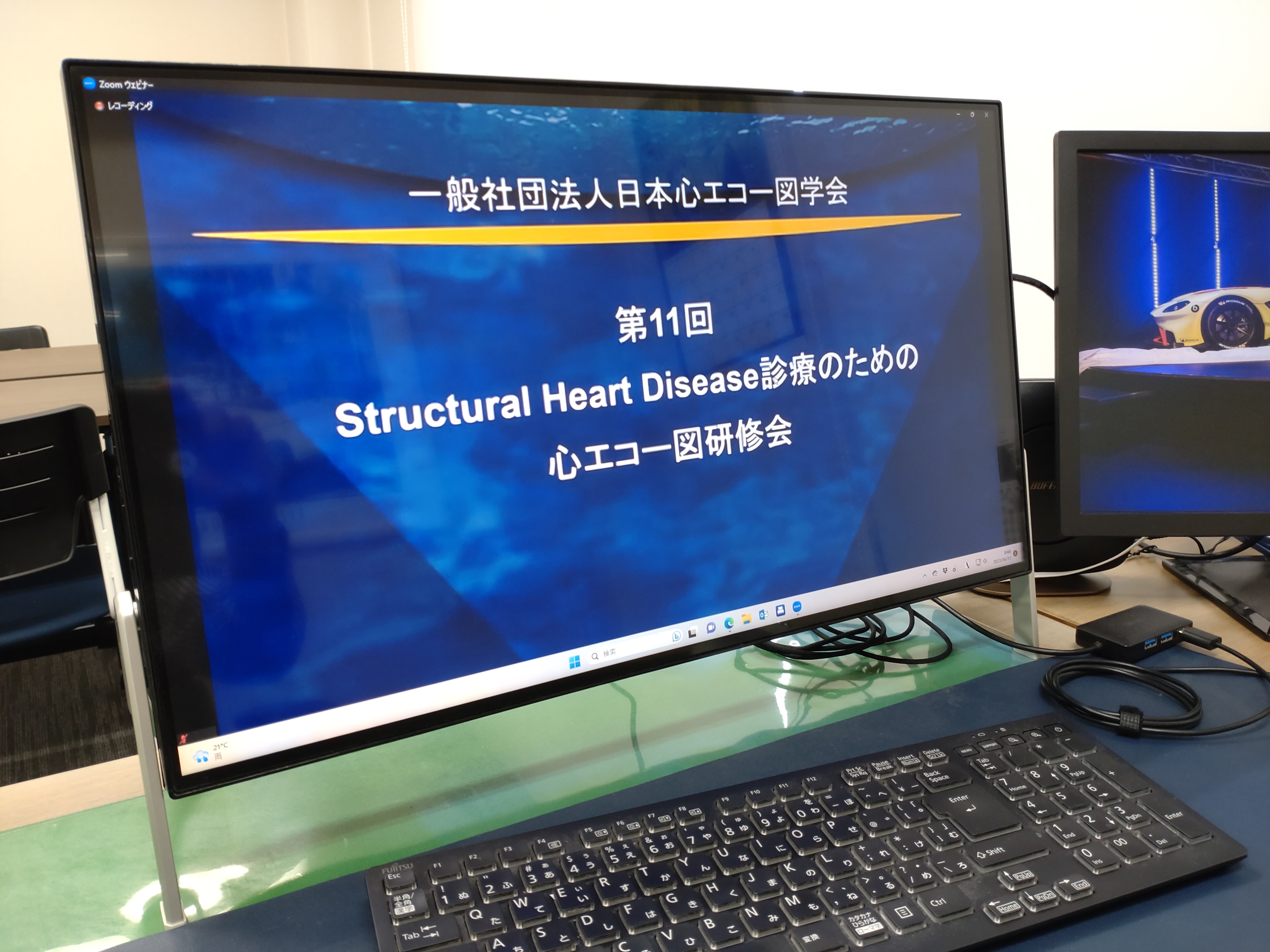 ★値下げ可能★図説臨床心エコー図(金原出版株式会社)外箱なし 心エコー図撮像必携 | 診断と治療社